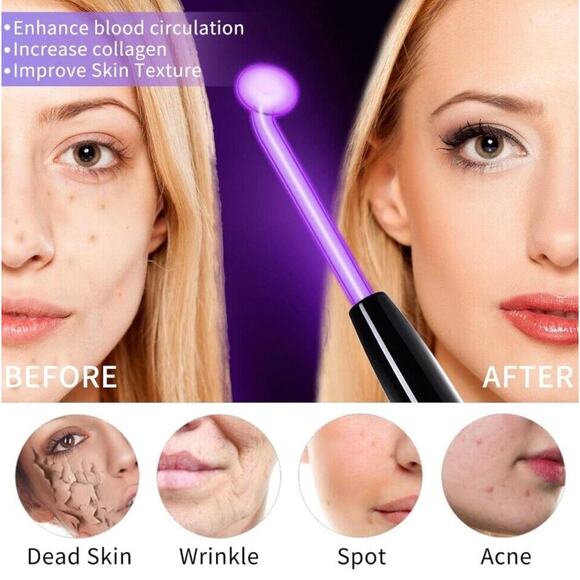 Upgrade High Frequency Facial Wand Anti-Aging Hairgrowth Portable Glass Wand - Picture 5 of 8